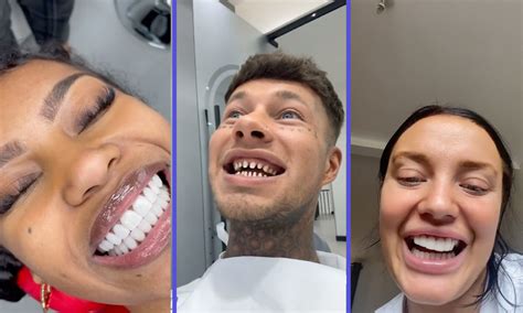 TikTok users share their worst veneers experience