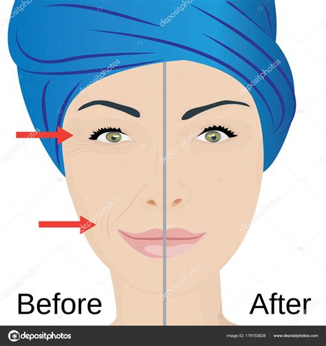 Aging face treatment. Before and after — Stock Vector © crazy ...