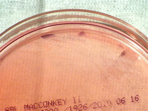 Gratis bilde: Brucella suis, bakterier, vokst, macconkey, agar, periode