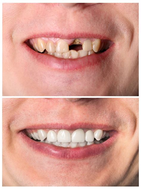 Tooth Restoration & Restorative Dentistry in Murfreesboro TN