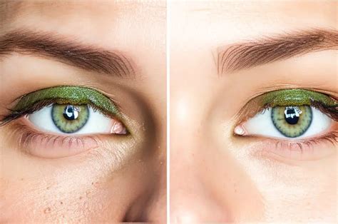 11 More Benefits of Aloe Vera Under Eyes Before and After