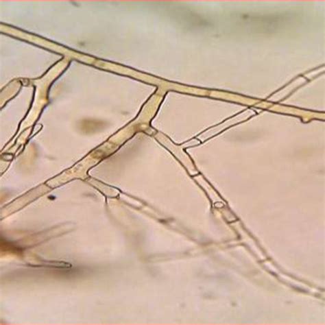 Rhizoctonia solani mycelium with right angled branching and constriction | Download Scientific ...