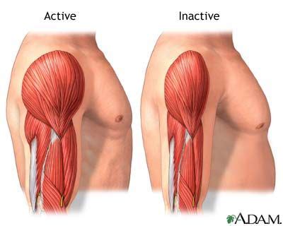 Inactive muscles turns into fat. | Muscle atrophy, Muscle, Bodybuilding workouts