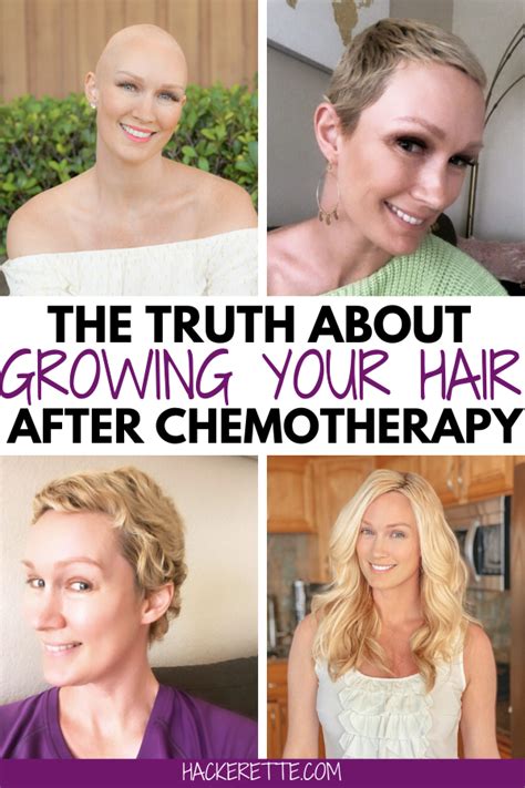 Chemotherapy Hair Loss Timeline