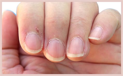 What do Cuticles say about your health. | Elim Spa Products