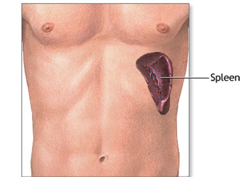 Splenic Injury | Korey Stringer Institute