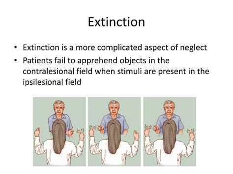 PPT - Hemispatial Neglect PowerPoint Presentation, free download - ID ...