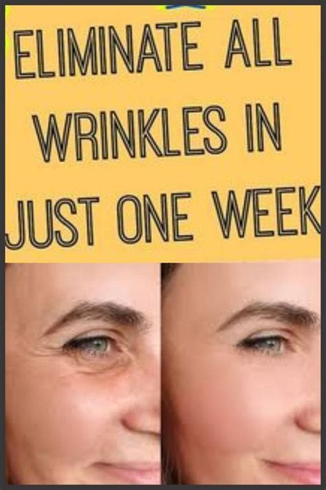 How to Get Rid of Dark Spots & Wrinkles at Home Naturally | Mouth ...