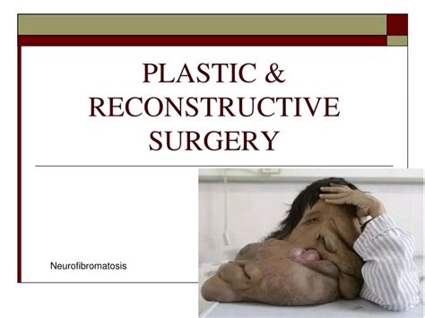 PPT - PLASTIC & RECONSTRUCTIVE SURGERY PowerPoint Presentation, free ...