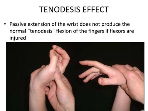 PPT - Cut Wrist & Flexor tendon injury PowerPoint Presentation - ID:7081690