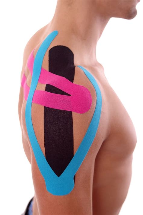 Corso Taping Kinesiologico | Evolution Academy®