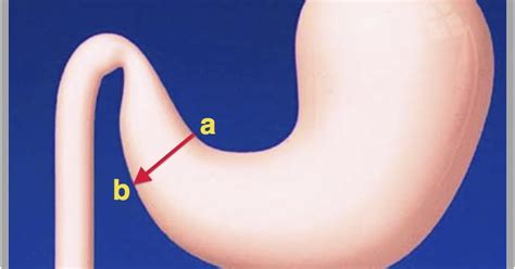 Veterinary Key Points: Incisional Gastropexy: Detailed description and video!