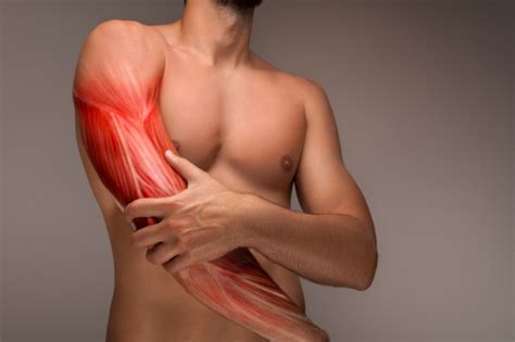 Discover the Common Causes of Upper Arm Pain - Sport Doctor London