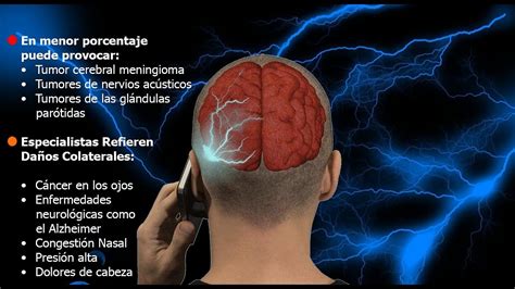 Síntomas tumor cerebral ⊛ ¡Prevención y Tratamiento 2020!