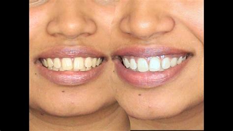 Diy Turmeric Teeth Whitening Paste : 4 Natural Diy Teeth Whitening Recipes Simple Pure Beauty ...