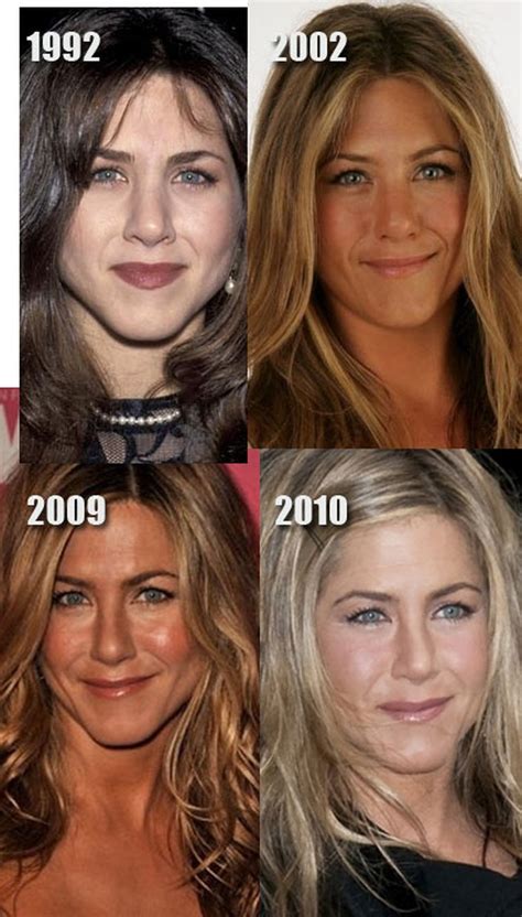 Celebrity Nose Jobs: Jennifer Aniston Nose Job Before and After Plastic Surgery