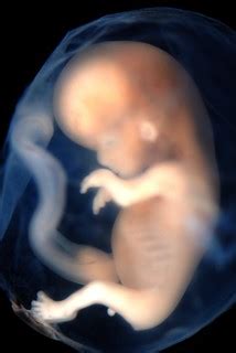 Embryo week 9-10 | Notable in the this fetus is an extraembr… | Flickr