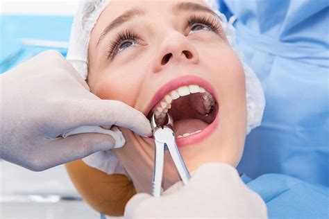 How Long Is Wisdom Teeth Surgery – Boston Dentist – Congress Dental ...