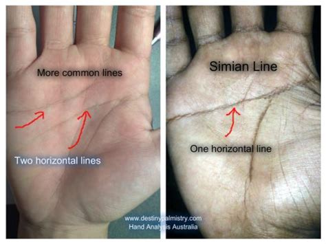 Simian Line Personality Survey - Destiny Palmistry