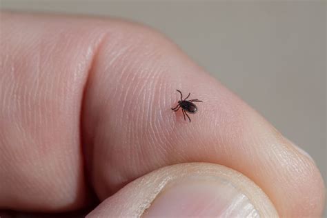 Alpha-gal syndrome, a meat allergy caused by lone star ticks, is becoming more common, CDC ...