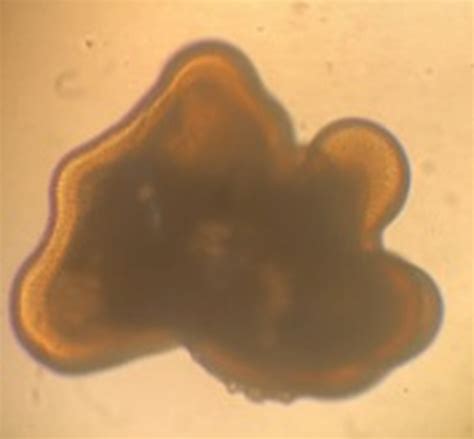 how rare is april 1 birthday 8