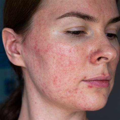 How to Choose the Right Commercial Construction Services Provider