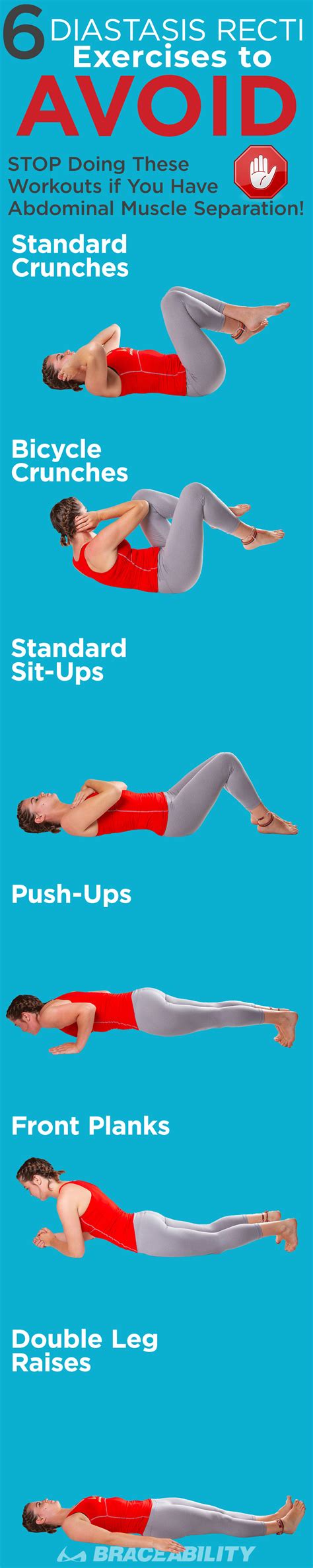 Diastasis Recti Exercises Program | EOUA Blog