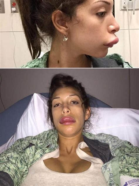 Die Schönheits-OPs der Stars