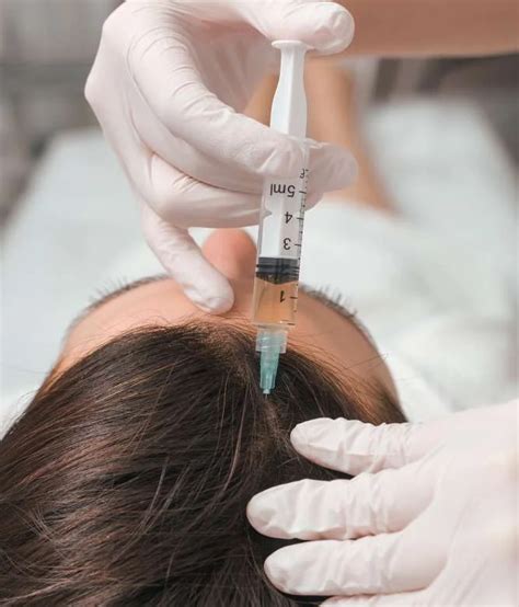 Power PRP Near Me In Dr.phillips | PRP Treatment In Orlando