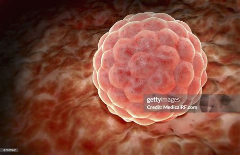 implantation high res vector graphic getty images