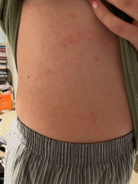 Are these bed bugs? Panicking…. : r/Bedbugs