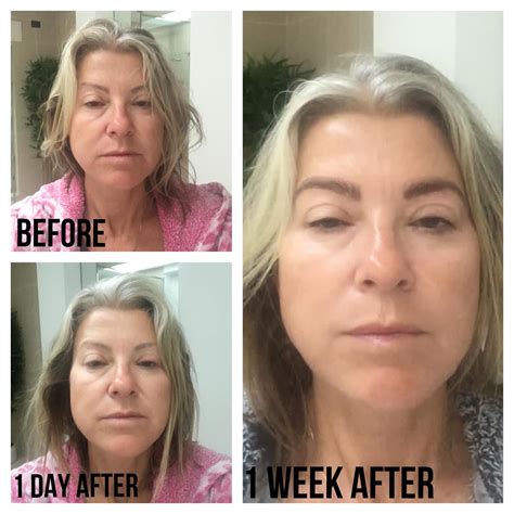 Is Green Spa Kawkawlin REALLY Worth The Hype? (Shocking Results Inside!) Image 14