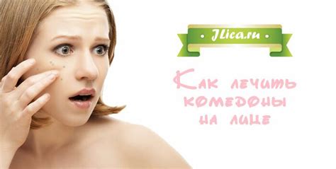 Что такое комедоны и как очистить закупоренные поры - jlica.ru