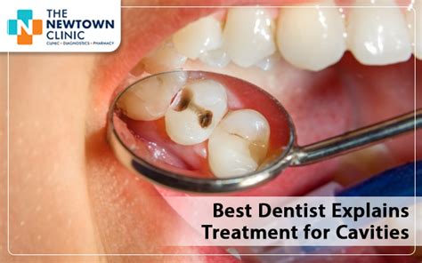 Best Dentist Explains Treatment for Cavities - The New Town