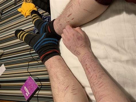 3410 best Self Harm images on Pholder | Self Harm Scars, Selfharm Memes