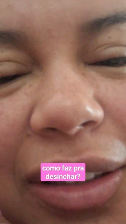 Quanto Tempo Demora Pro Olho Desinchar Depois De Chorar - COMO DESINCHAR OLHOS INCHADOS DE TANTO CHORAR? #shortsvideo - YouTube