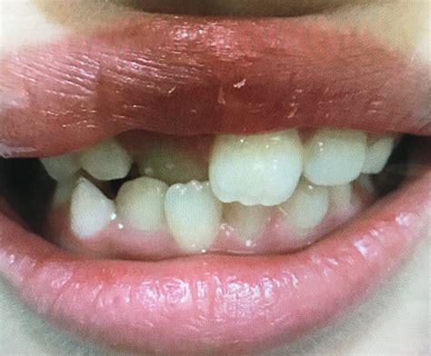InfluencerGoneWild's Secret To Success: Their Amazing Before & After. Image 16