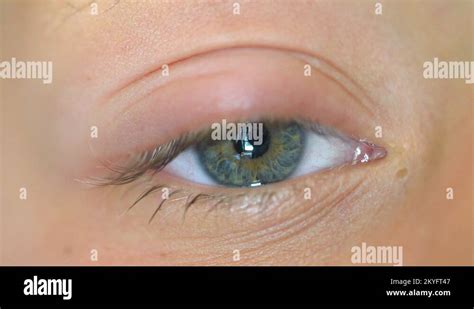 Stye eye Stock Videos & Footage - HD and 4K Video Clips - Alamy