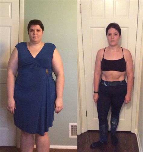Weight Loss Before And After Gastric Sleeve at Harold Herron blog