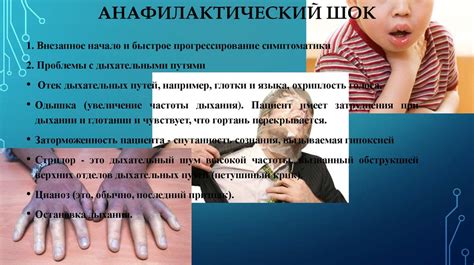 Анафилактический шок - презентация онлайн