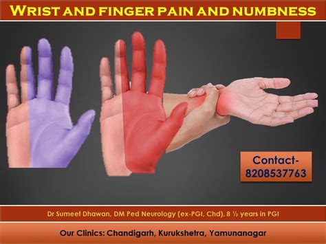 numbness  hands act    late dr sumeet dhawan