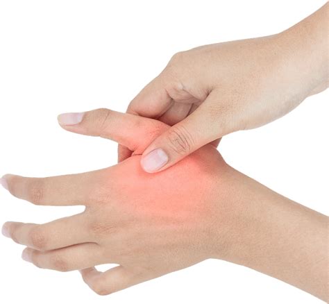 Peripheral Neuropathy Hands