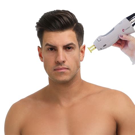 men face laser hair removal 1