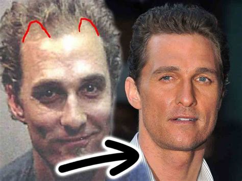 Matthew McConaughey Hair Loss Secrets Revealed!