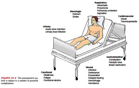 Perioperative Nursing: POSTOPERATIVE COMPLICATIONS