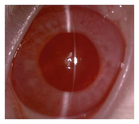 Representative anterior-segment photographs of rabbit eyes. Photographs ...