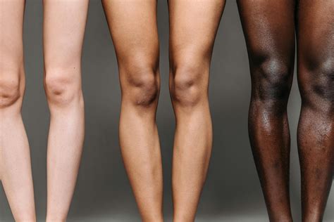 Patellar Injuries Explained - London Cartilage Clinic