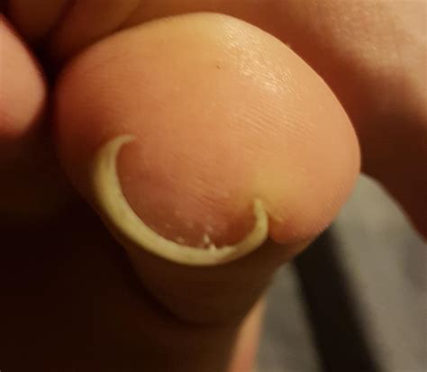 Is this.... valid? Wat do? Keeping the nail longer than the toe for now