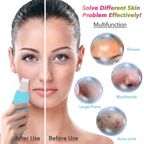 face and skin 9