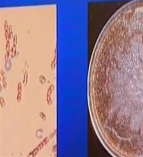 russian scientists find ancient bacteria   lead  elixir